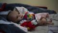 Unter den Taliban in Afghanistan: Eine Million Kinder vom Hungertod bedroht