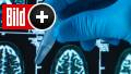 Wirkstoff wird erstmals am Menschen getestet: Alzheimer-Impfung in Aussicht
